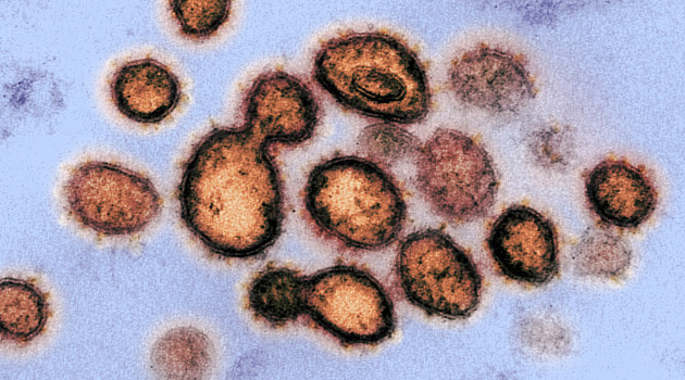 Una imagen del coronavirus tomada con un microscopio electrónico en un laboratorio de EE.UU. el 27 de febrero de 2020. /Foto: National Institutes of Health (AFP)