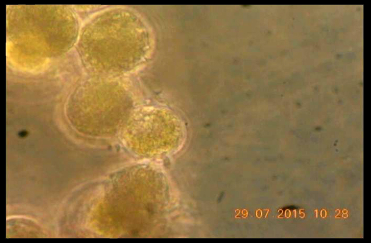 Vista ampliada en el microscopio de la Vulcanodinium rugosum, microalga causante de lesiones dermatológicas durante el verano de 2015.