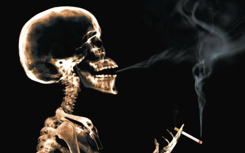 Cada cigarrillo acorta en siete minutos la vida del fumador, cuya expectativa de vida, por esa causa, disminuye como promedio 20 años en personas de mediana edad. /Foto ilustrativa