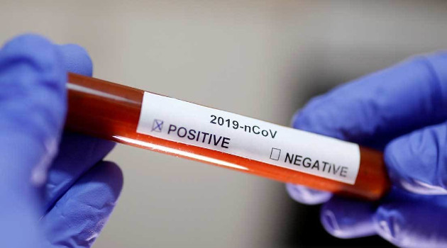 Tubo de ensayo con el nombre del coronavirus en la etiqueta, tomada el 29 de enero de 2020. /Foto: Dado Ruvic (Reuters)