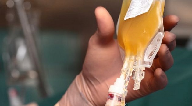 Varias provincias de Cuba ya aportan trasfusiones de plasma convalenciente para pacientes críticos de Covid-19./Foto: Internet.