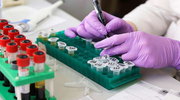 Rusia planea iniciar en mayo próximo las pruebas pre-clínicas contra el coronavirus SARS CoV-2. Las comprobaciones realizadas ahora en animales concluirán a finales de abril. /Foto: Prensa Latina