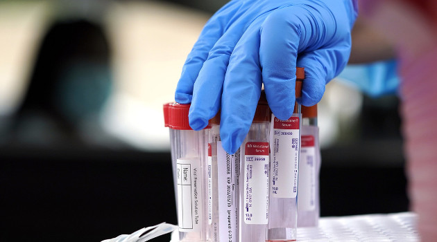 Un profesional sanitario selecciona un tubo de ensayo en un centro médico de Houston (Texas, EE.UU.), el 26 de junio de 2020. /Foto: David J. Phillip (AP)