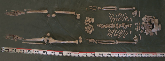 Con la aplicación de técnicas de arqueología forense, se rescataron 112 huesos y fragmentos de huesos. / Foto: cortesía de la ETAF