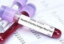 Universidad rusa producirá fármaco contra la hepatitis B Universidad rusa producirá fármaco contra la hepatitis B